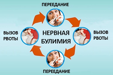 Лечение булимии в Песчанокопском